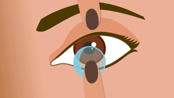 Fingers putting in a contact lens